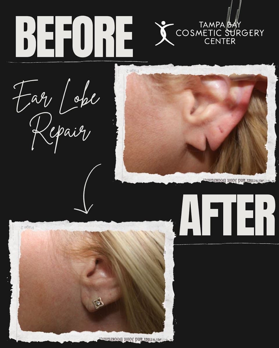 Tampa Bay Cosmetic Surgery Center photo 1 of 8