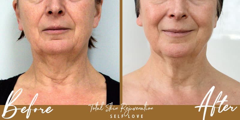 Total Skin Rejuvenation - Med Spa photo 1 of 8