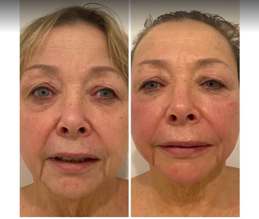 MySkin Face & Body Clinic