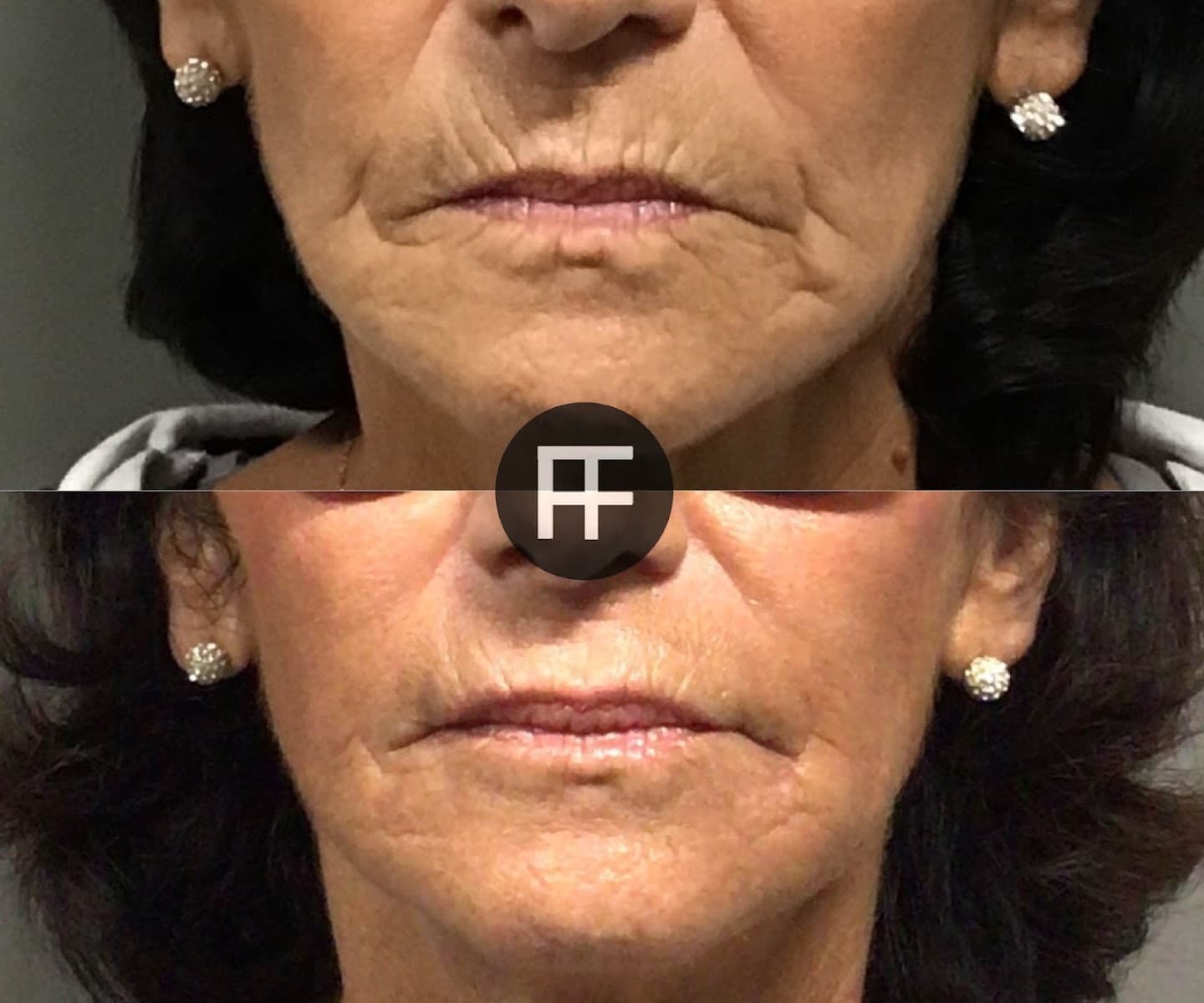 Face Forward Skin & Wellness Center