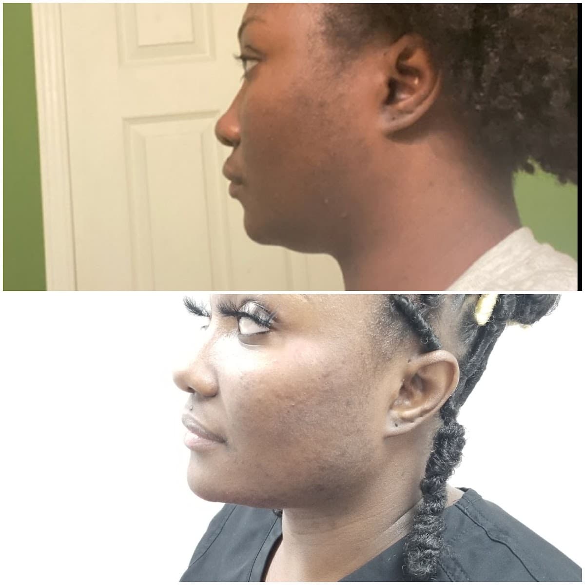 Natural Injections by Laura Medspa