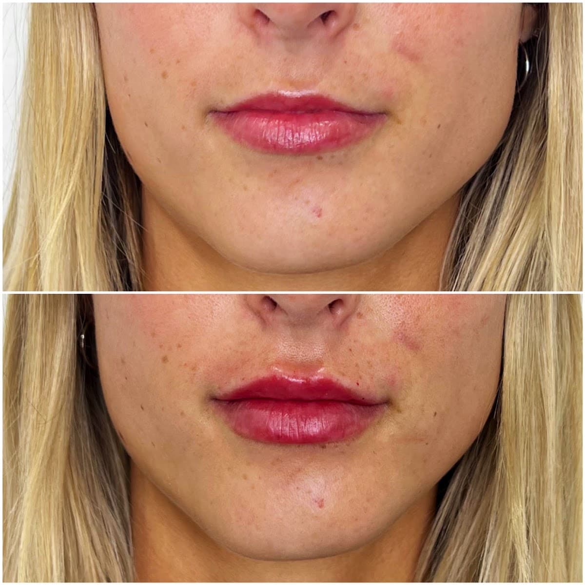 Beauty Nurse Jackie | Aluma Medical Aesthetics photo 1 of 8