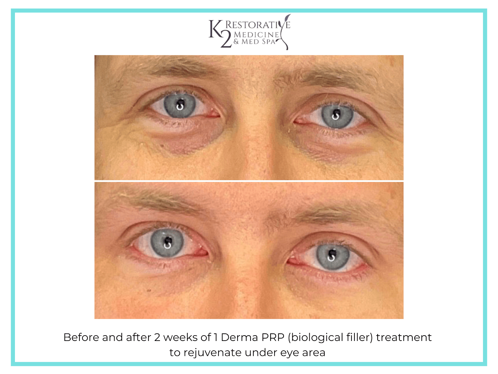 K2 Restorative Medicine & Med-Spa