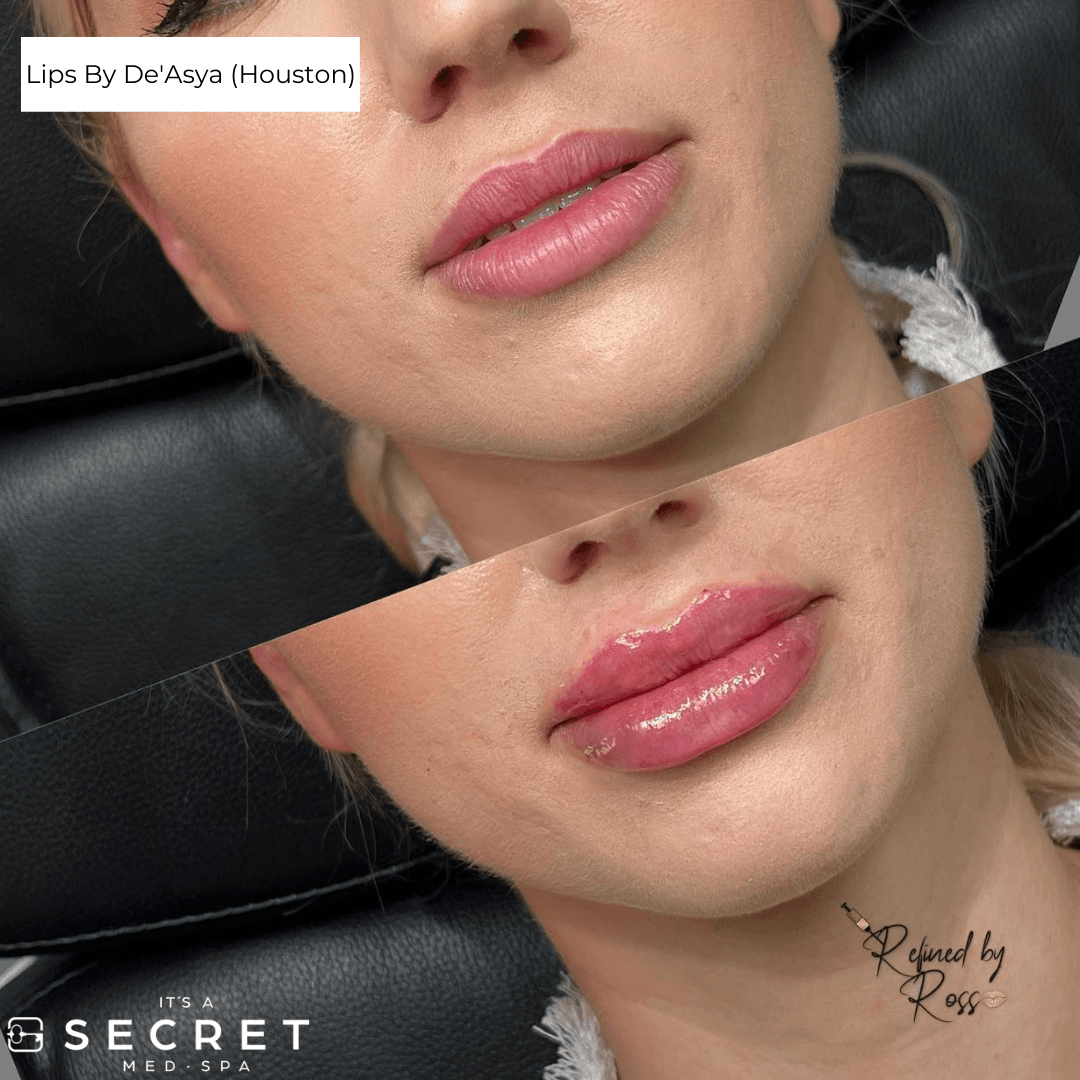 It's A Secret Med Spa - Houston photo 1 of 8
