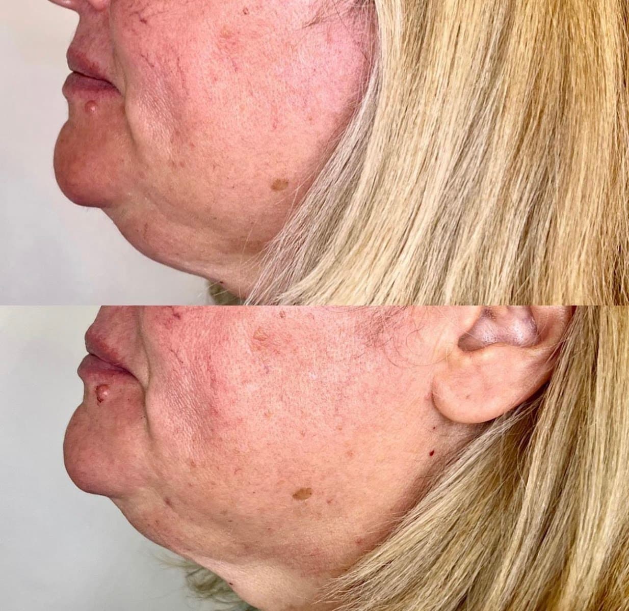 Monroe Medspa - Rochester