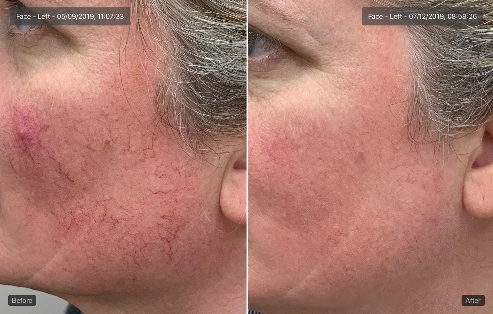 Tokarz Dermatology
