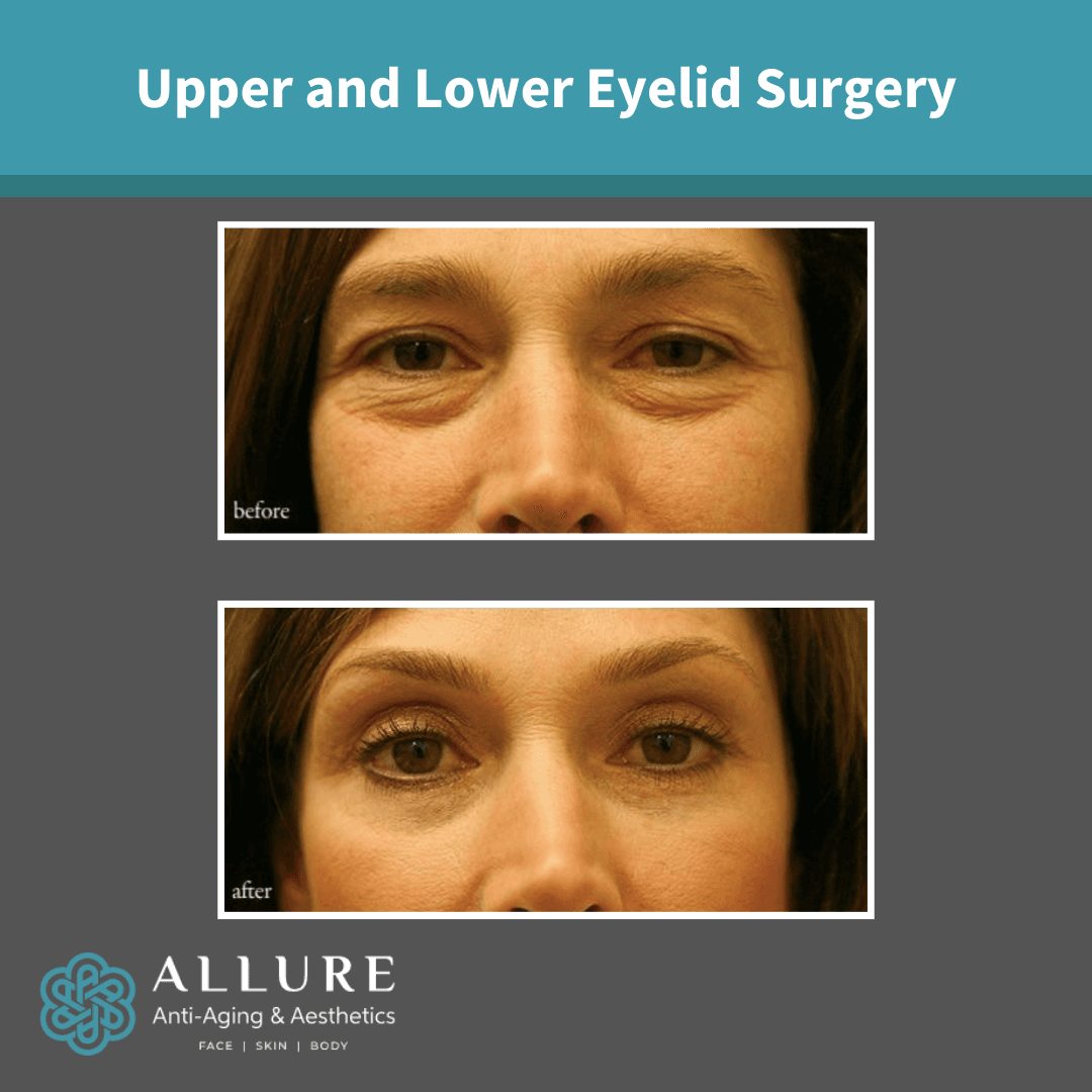 Allure Anti-Aging & Aesthetics