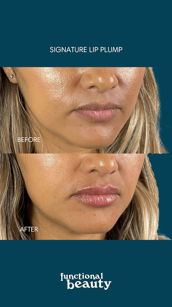 Functional Beauty Medical Spa Moorpark