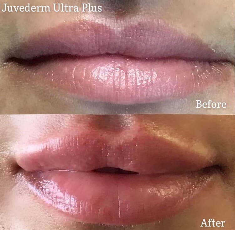 Estetica MedSpa