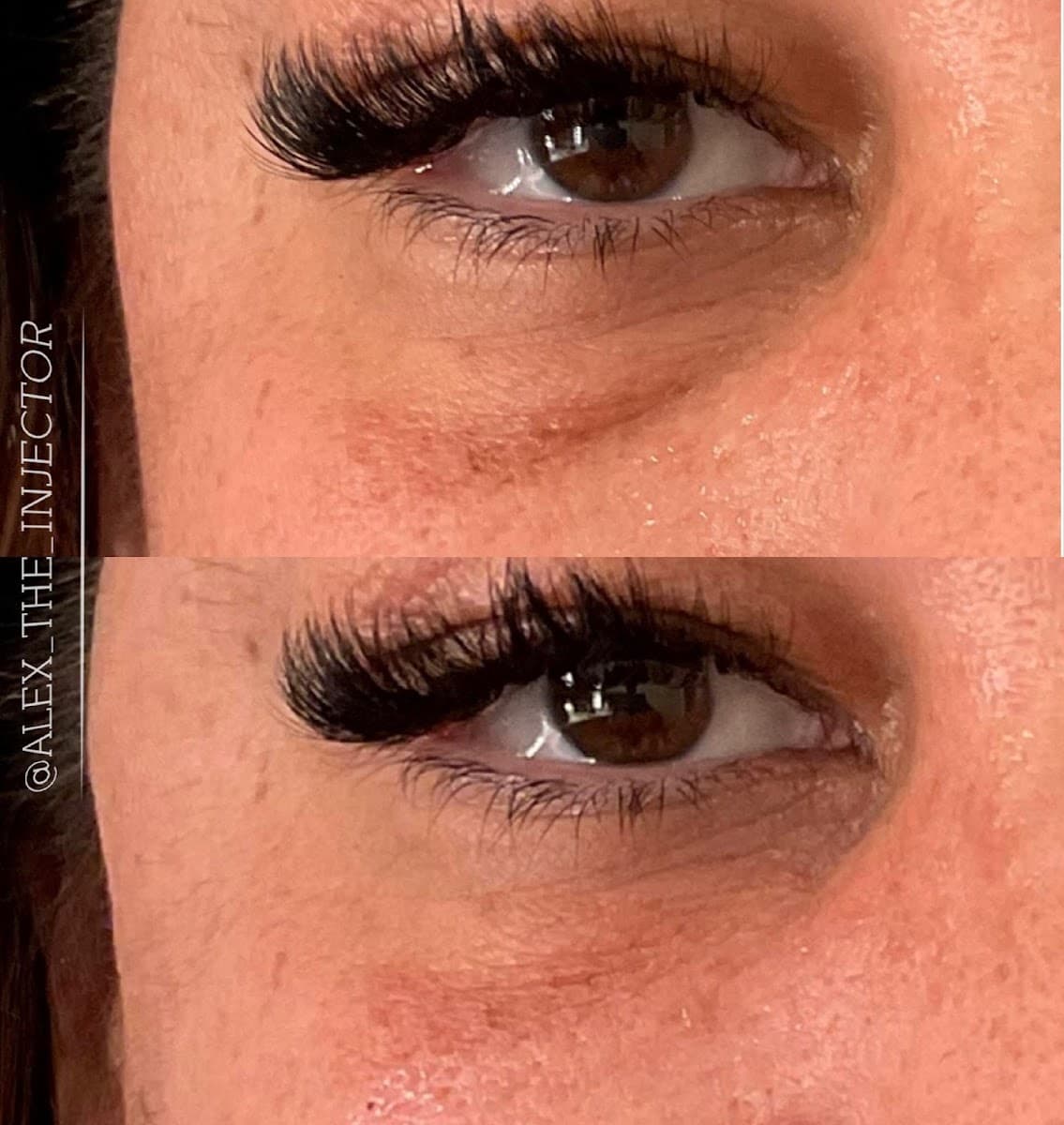 THE FACE LAB Medspa