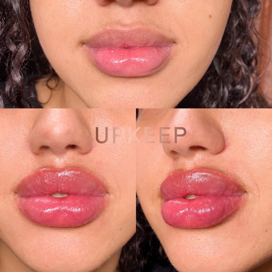 Upkeep Med Spa