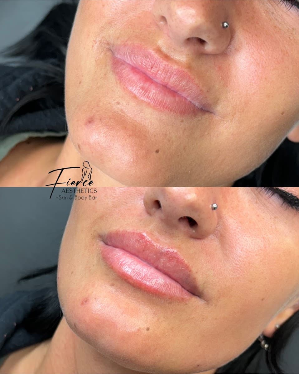 Fierce Aesthetics Medspa