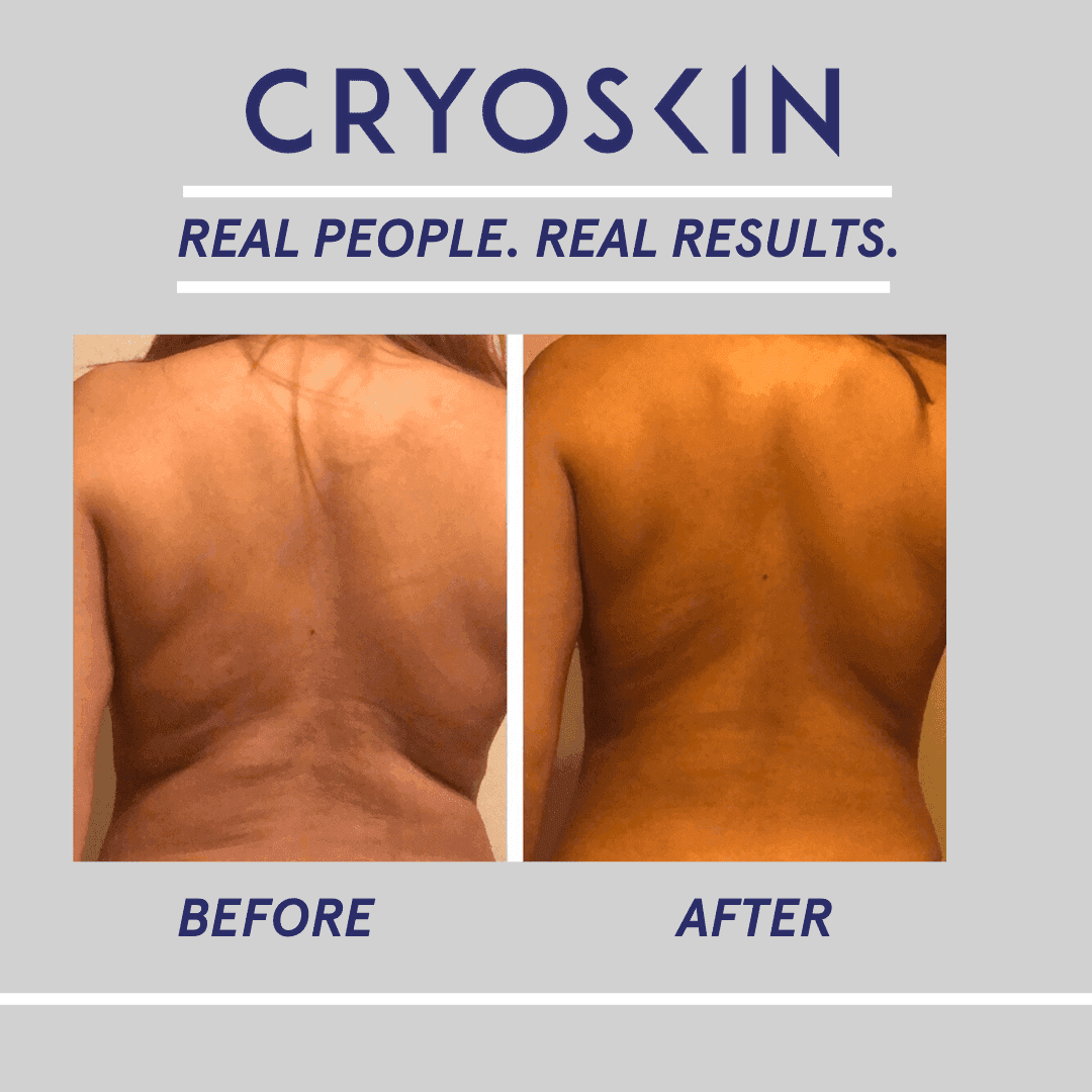 Bon Voyage Aesthetics & Body Sculpting,LLC