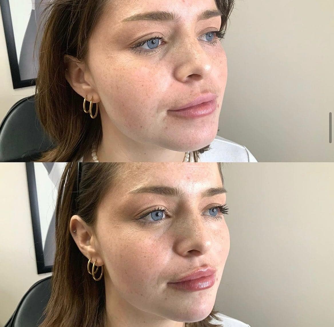 Flawless Skin Center - Glendale: Med Spa