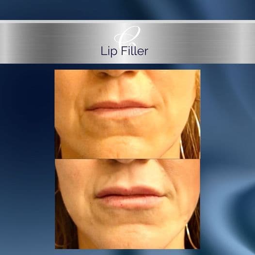 Concierge Aesthetics & Plastic Surgery