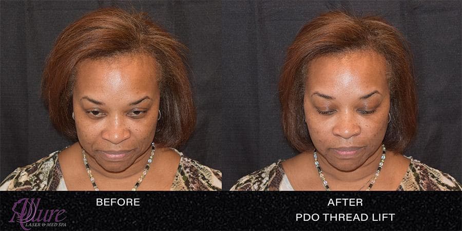 Allure Laser & Med Spa
