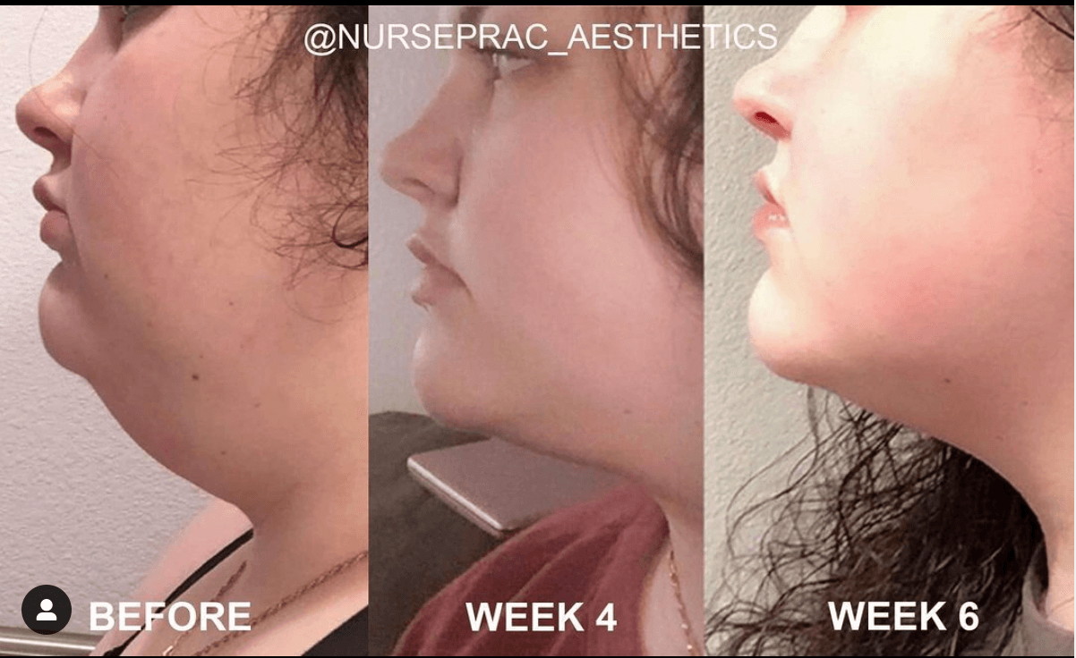 Northern Allure Aesthetics photo 1 of 8