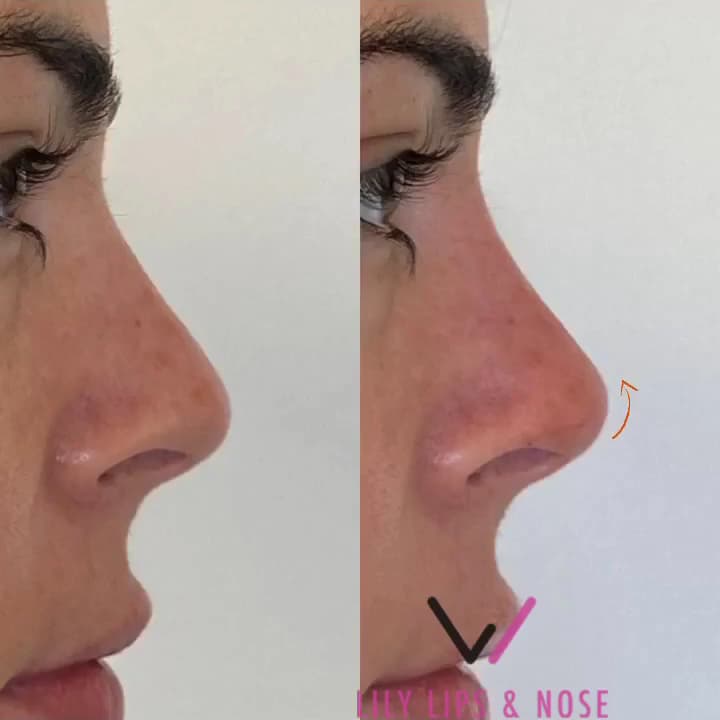 Lily Lips & Nose photo 1 of 8