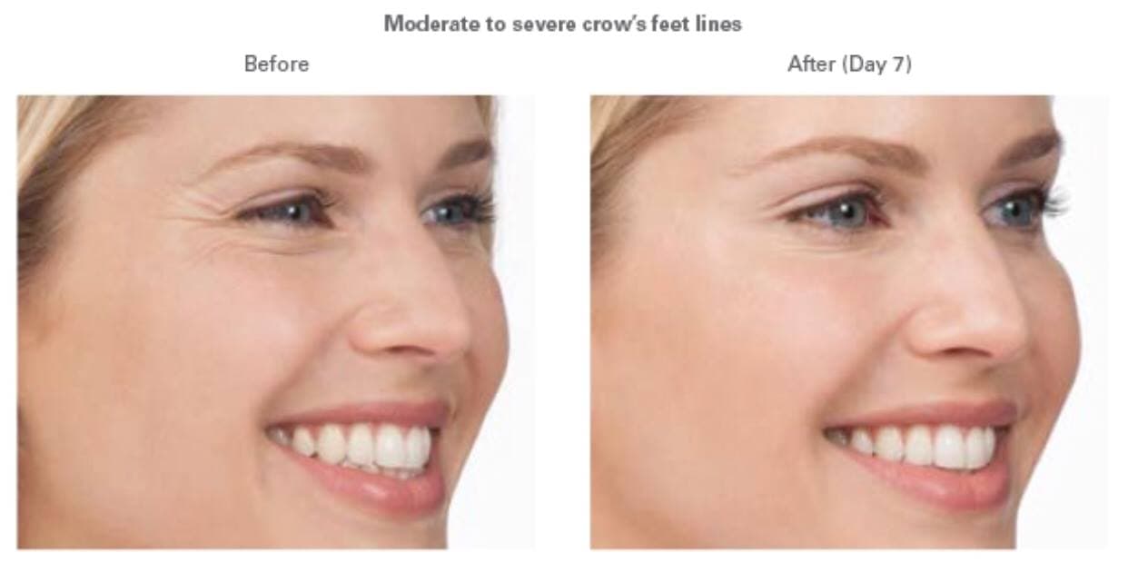 Epiphany Dermatology