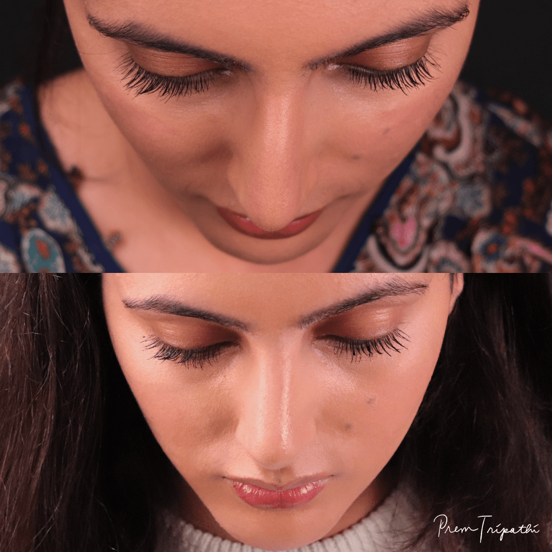 Bay Hills Plastic Surgery | Dr. Prem Tripathi