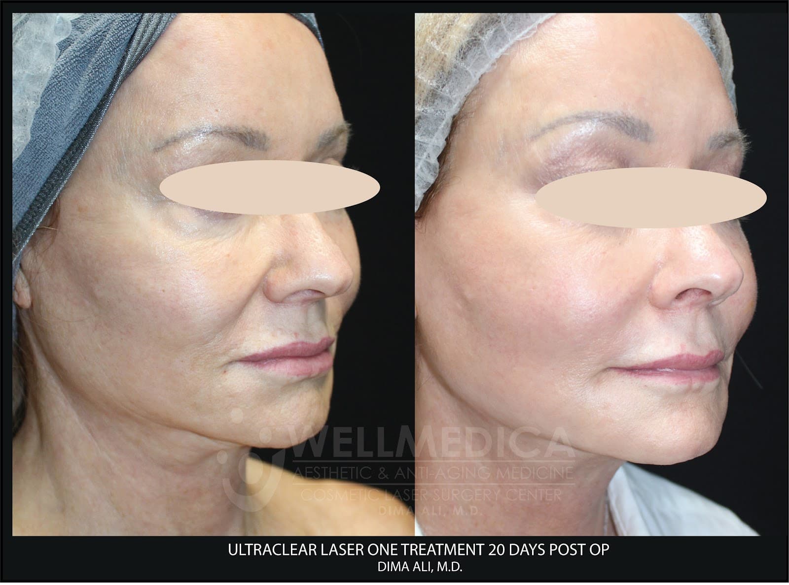 WellMedica Aesthetic & Anti-Aging Medicine - Dr. Dima Ali