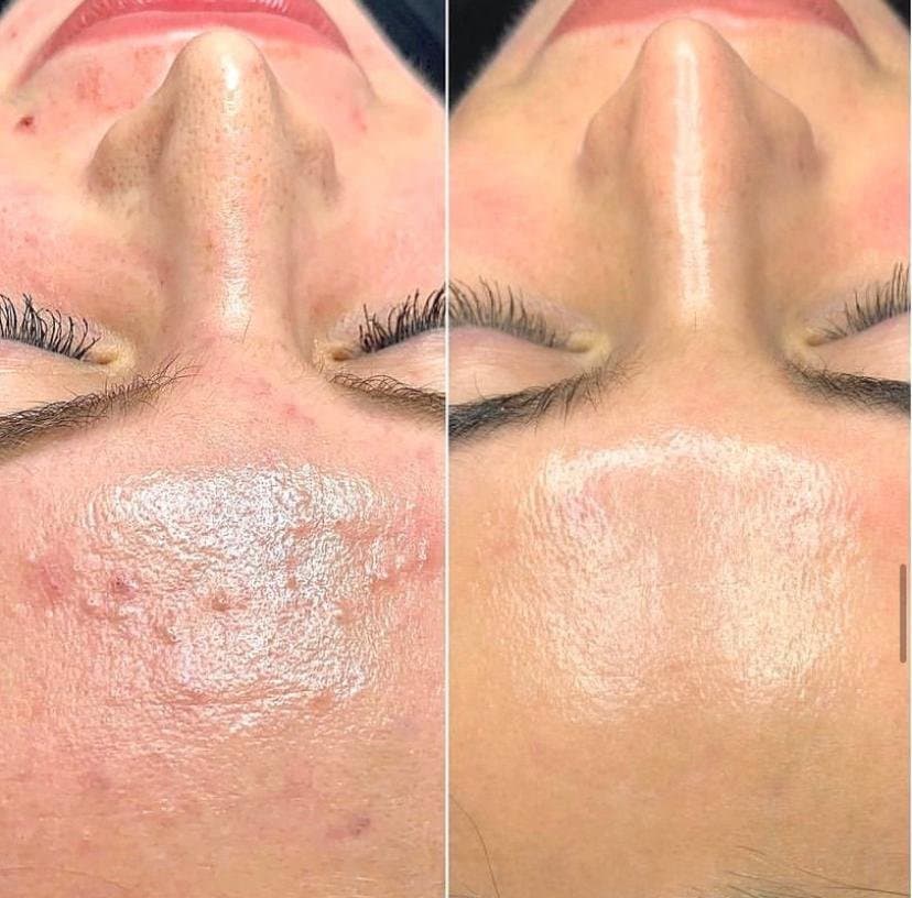 Face and Body by Lalita