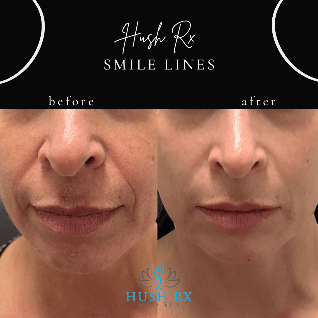 Hush Rx