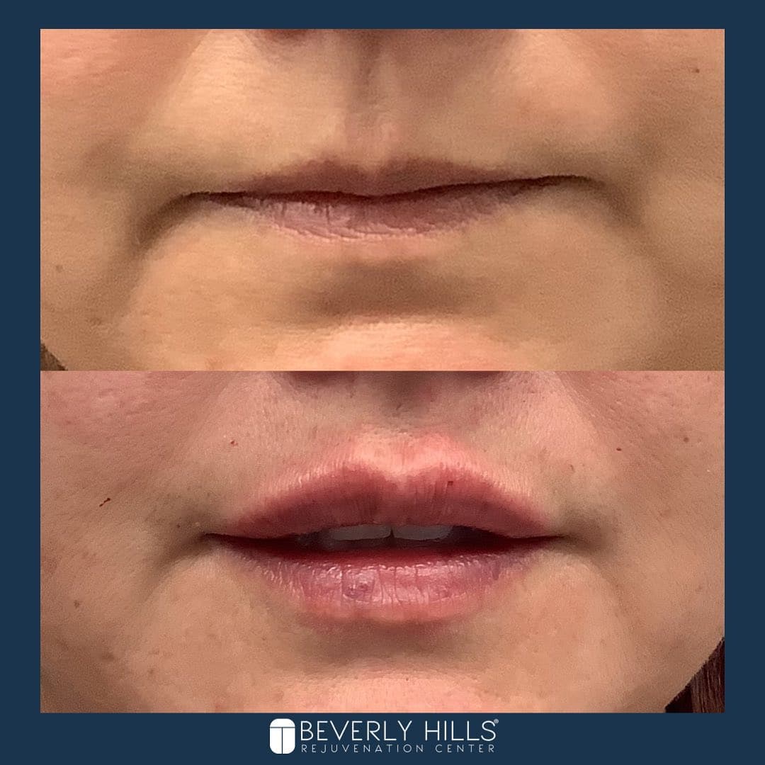 Beverly Hills Rejuvenation Center - Valencia