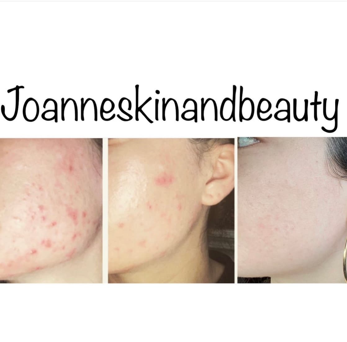 Beauty and the skin by Joanne LLC photo 1 of 5