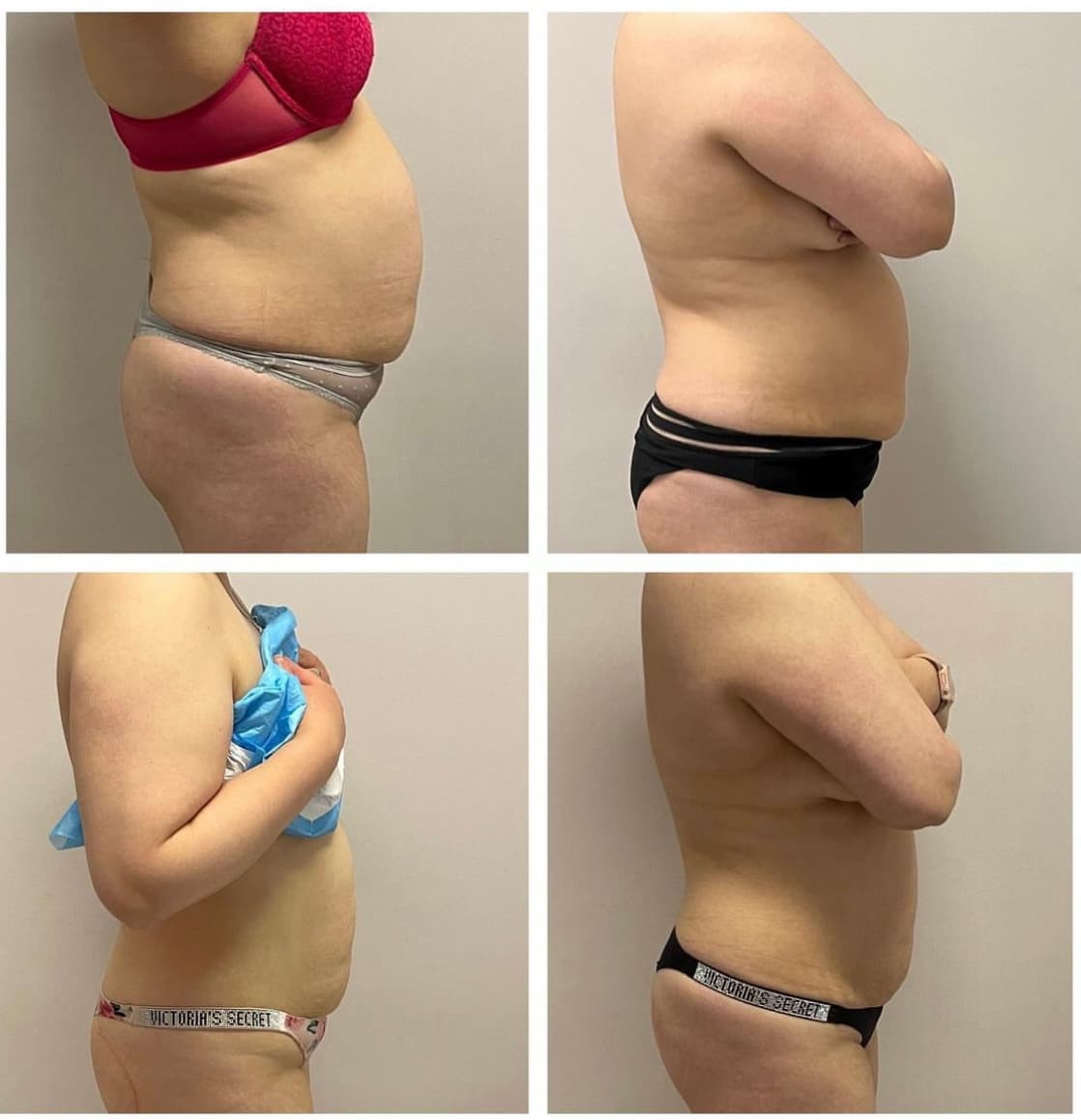 Rénu Body Sculpting