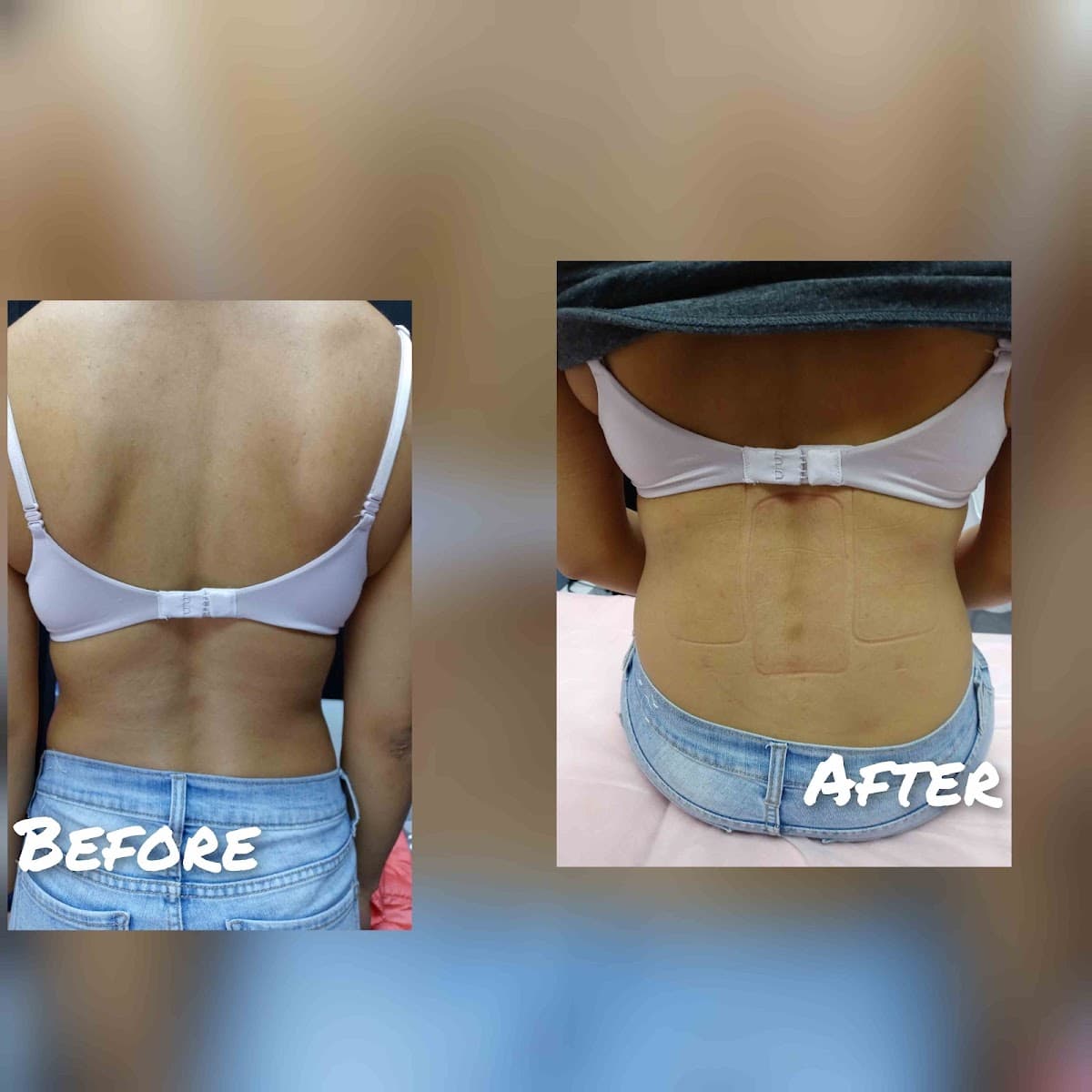 SoCo Body Sculpting L.L.C.