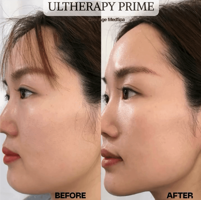 Zero Age MedSpa Katy