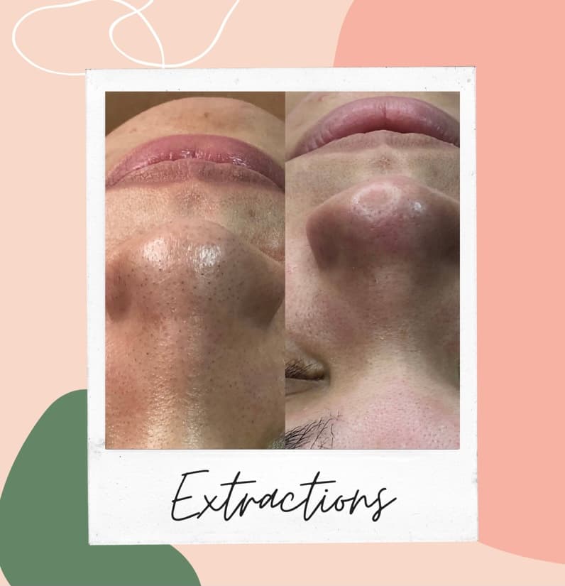 T's Skin Bar