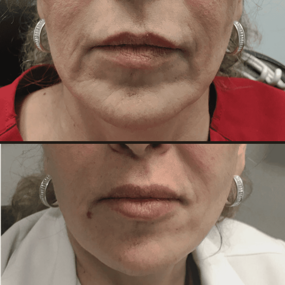 Venus Medspa
