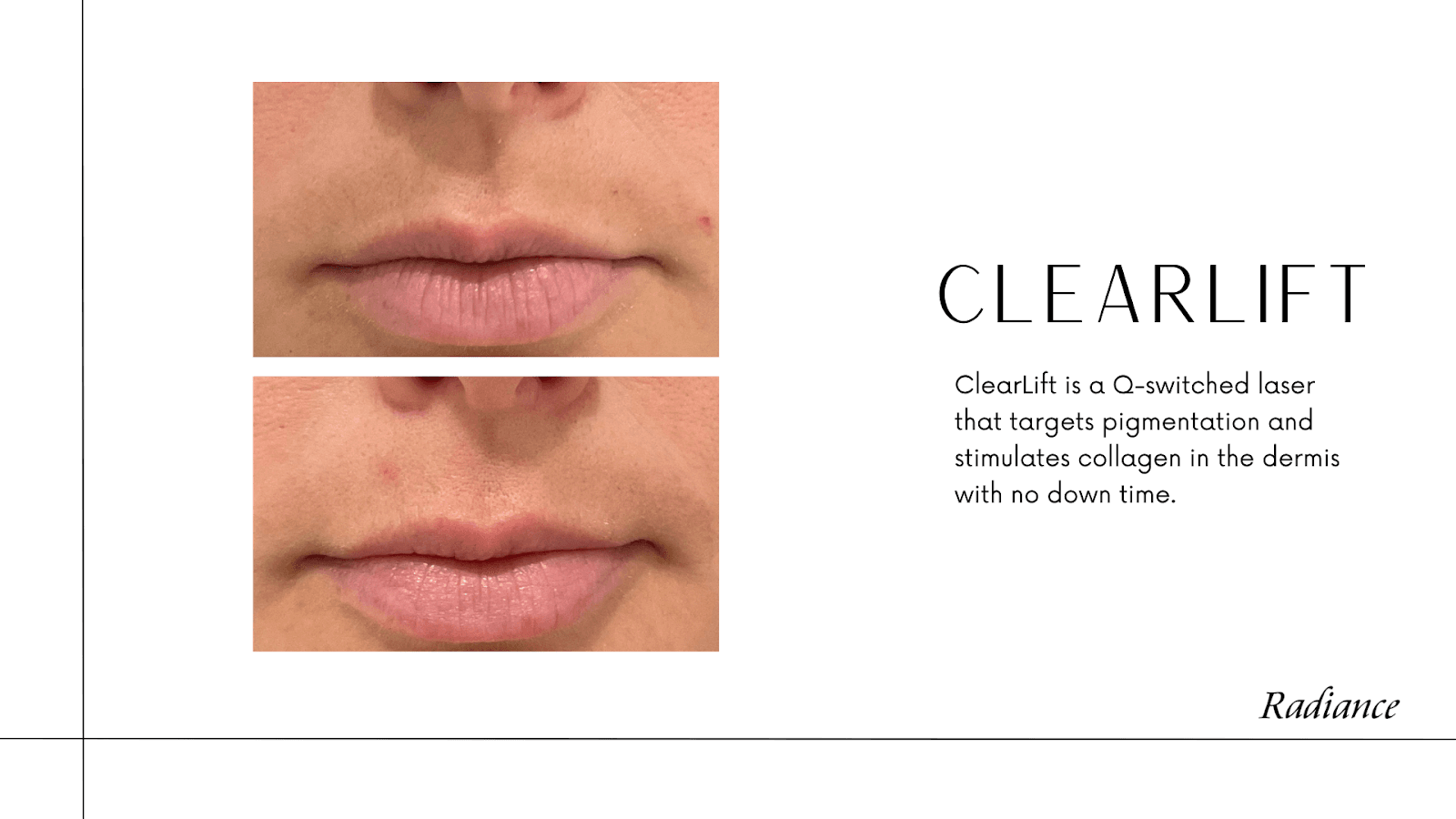 Radiance Skin Therapy & Laser Center