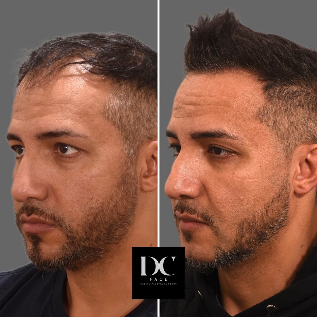 DC Face - Facial Plastic Surgery | Daniel Tran, MD