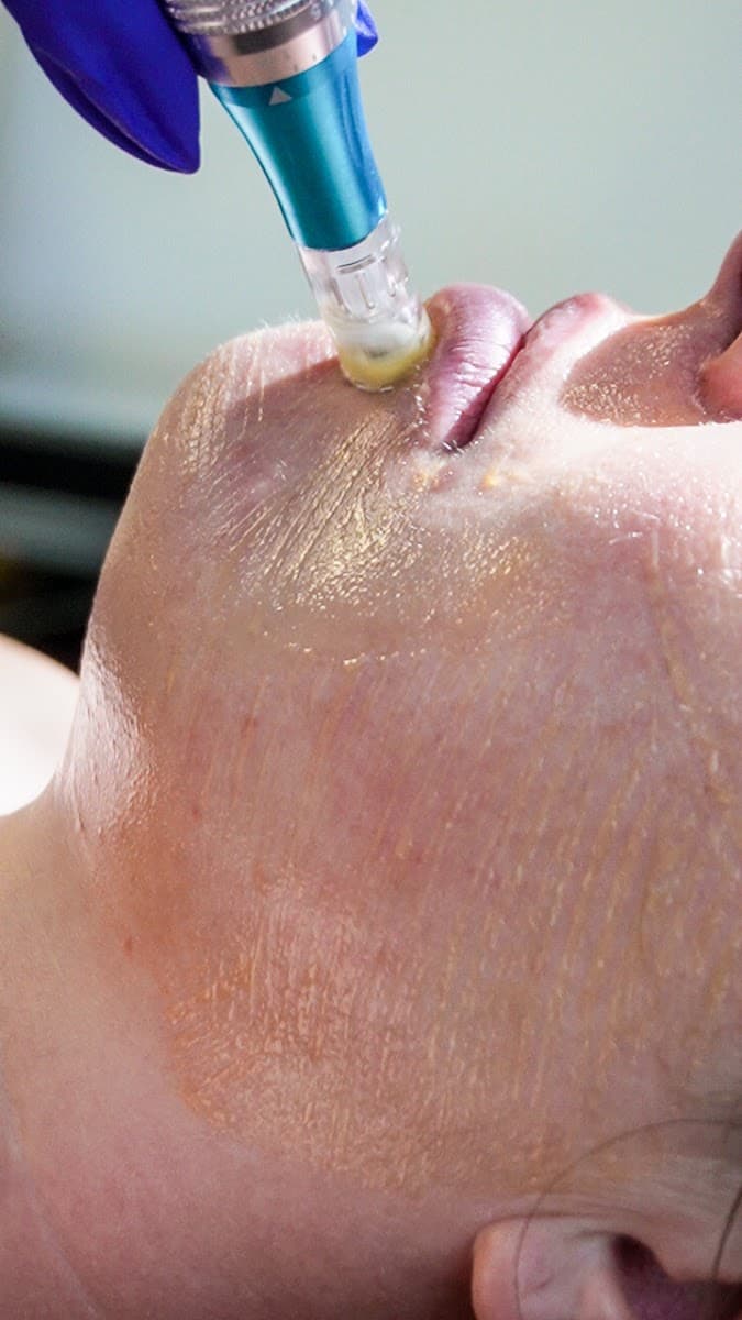 Honey Dipped - Health and Wellness Medical Spa