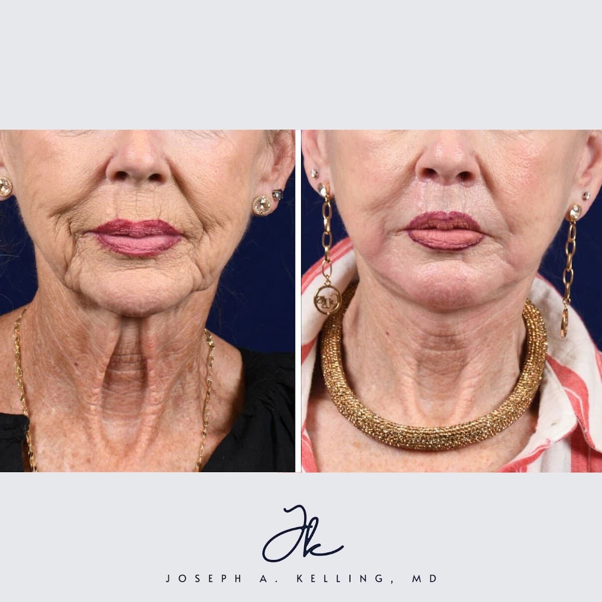 Kelling Plastic Surgery photo 1 of 8