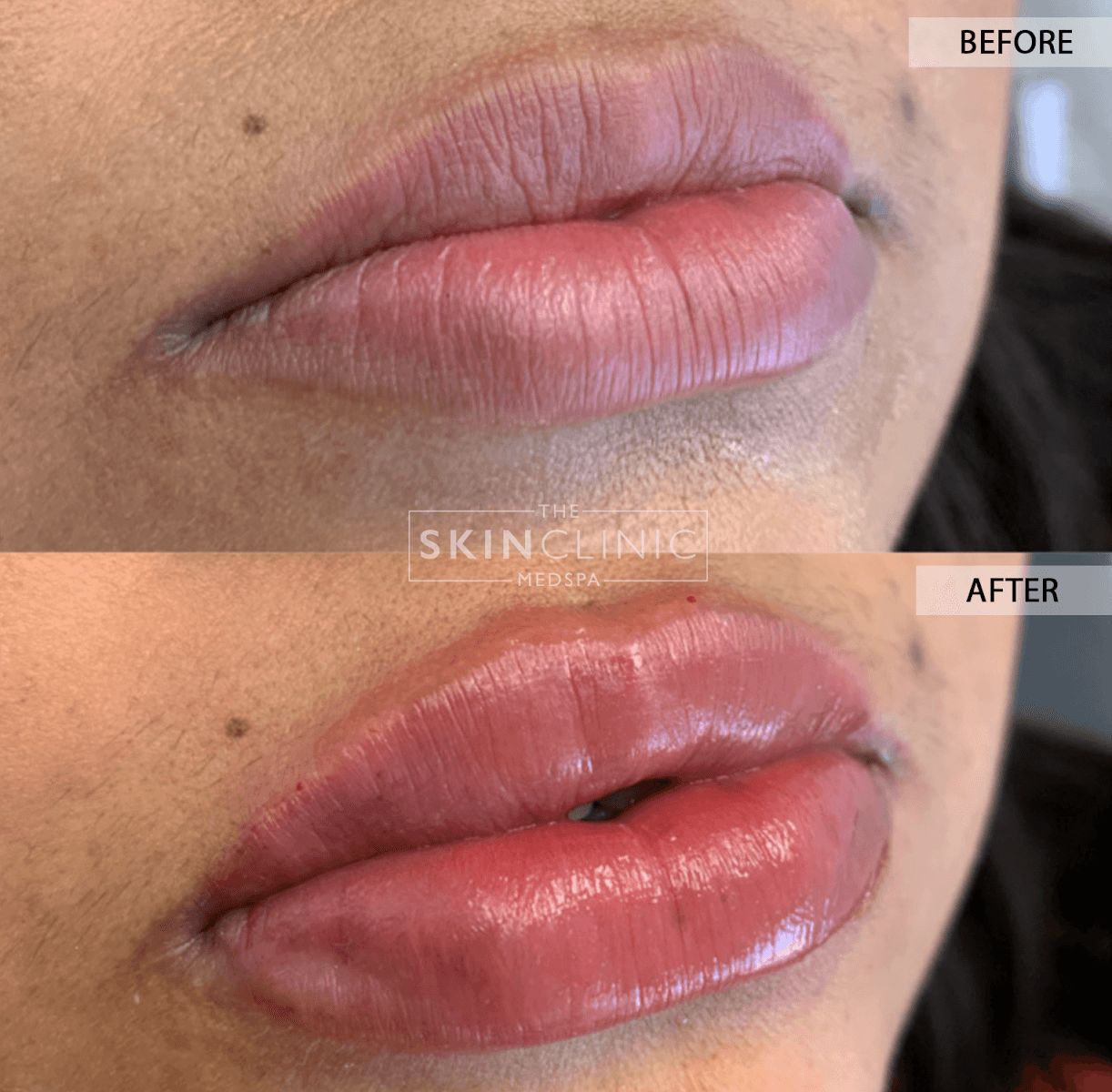 The Skin Clinic Med Spa