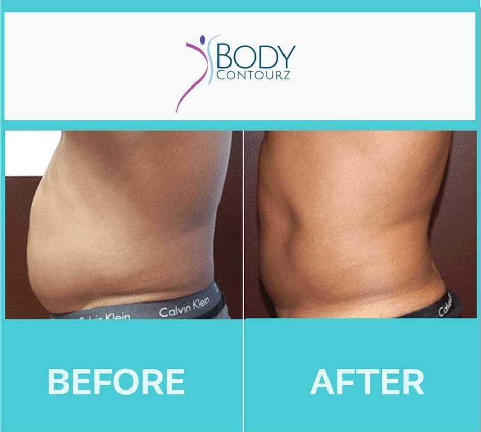 Body Contourz - Costa Mesa
