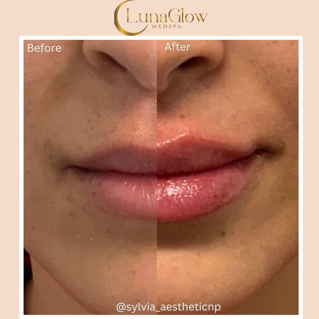 LunaGlow MedSpa®