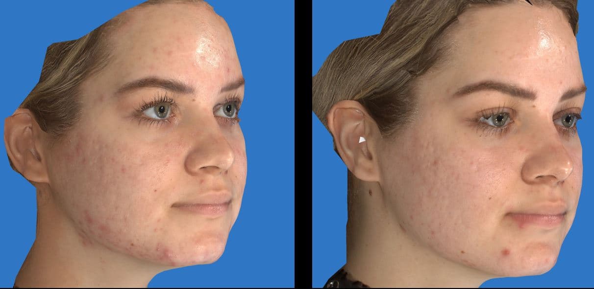 Arizona Facial Plastics
