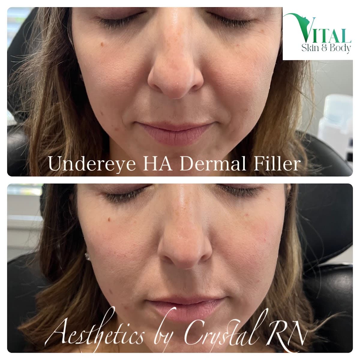 Vital Skin & Body Medical Aesthetics by Crystal