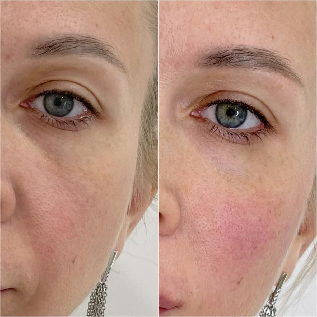 Medspa 33