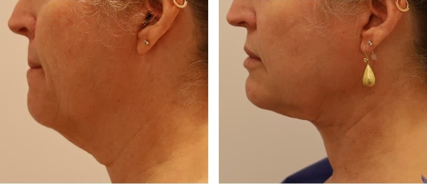 L Plastic Surgery - Charles K Lee, MD photo 1 of 8