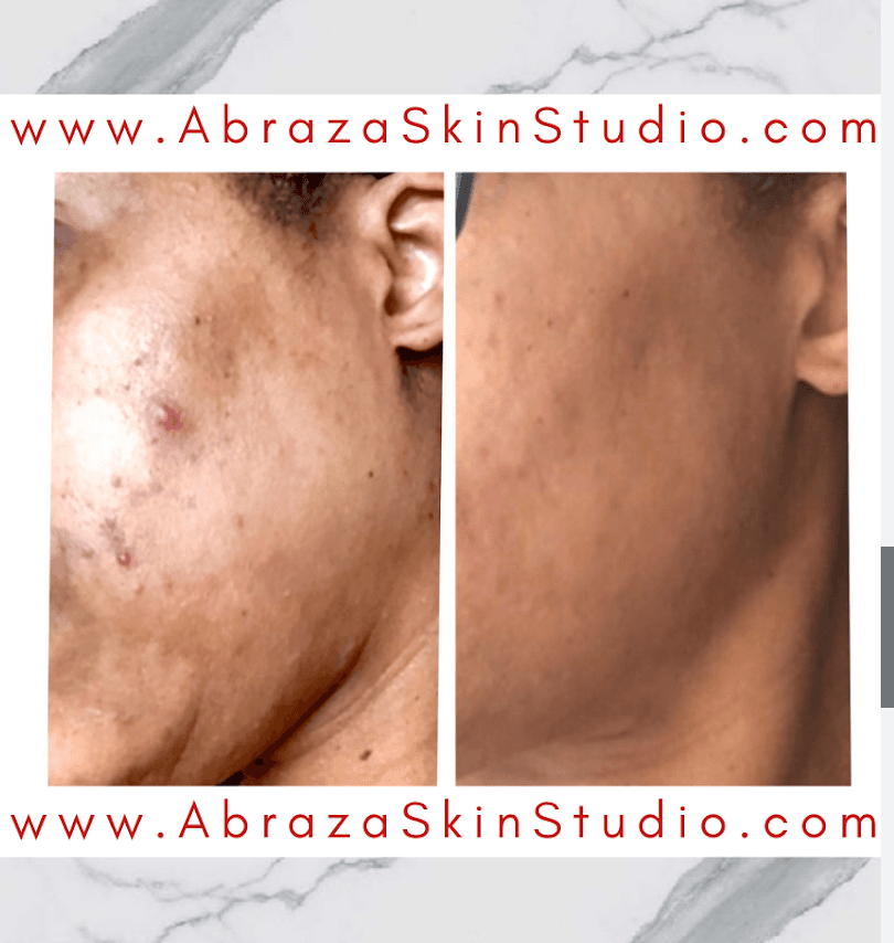 Abraza Skin Studio photo 1 of 8