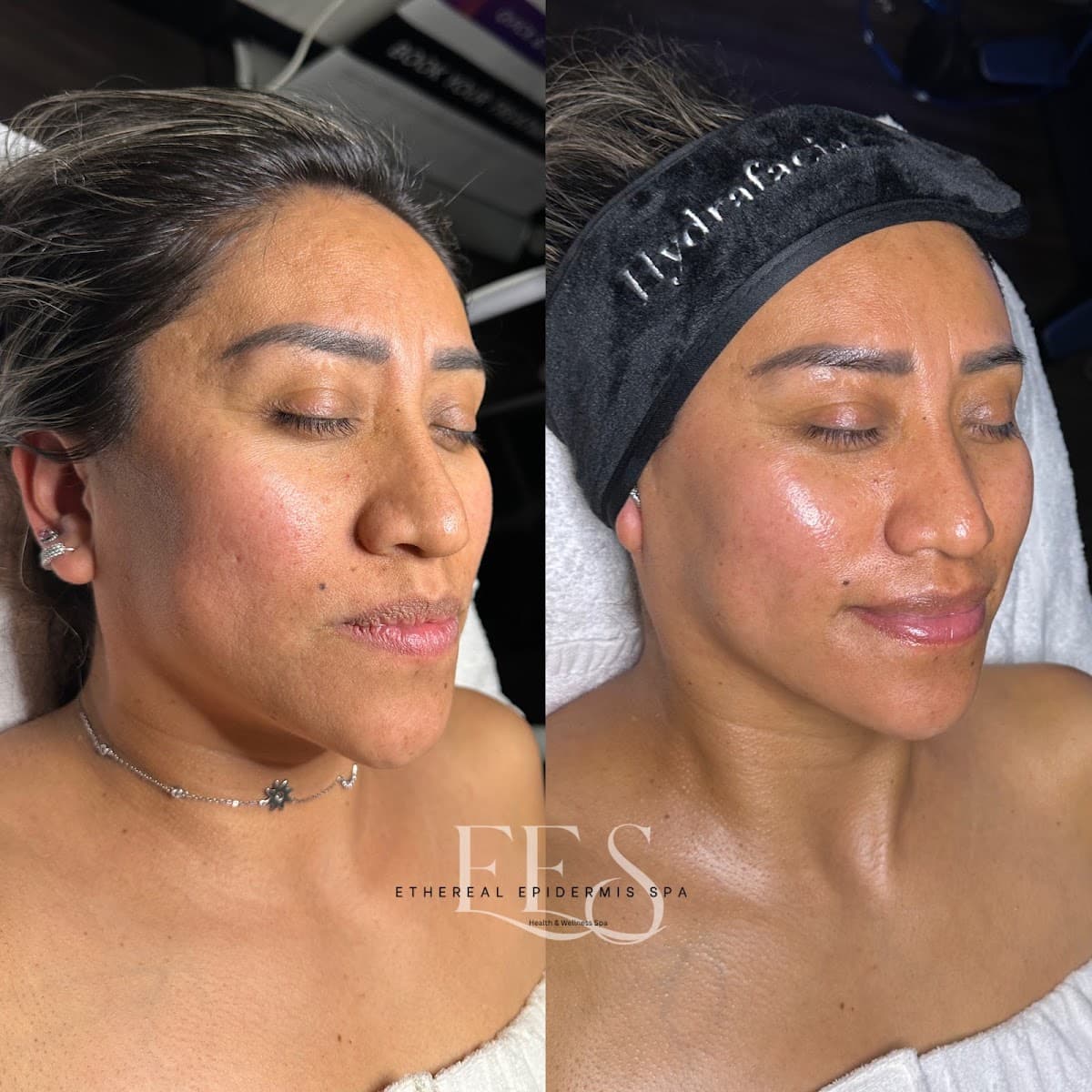 Ethereal Epidermis Spa photo 1 of 8