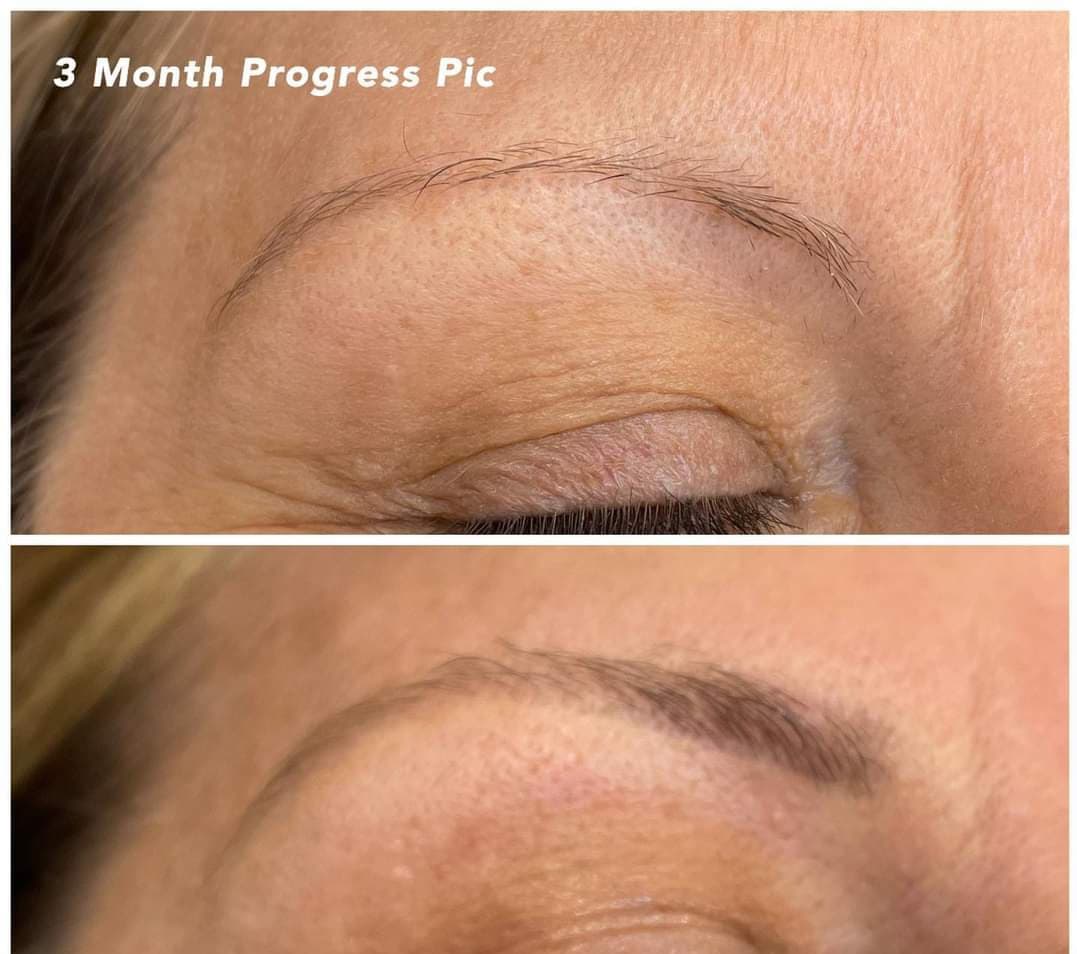 FlawlessSkin photo 1 of 8