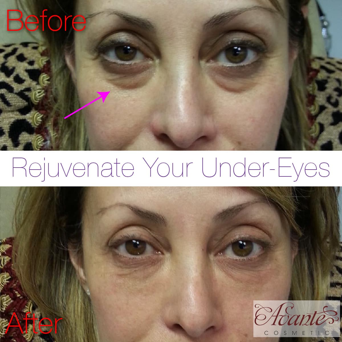 Avante Cosmetic