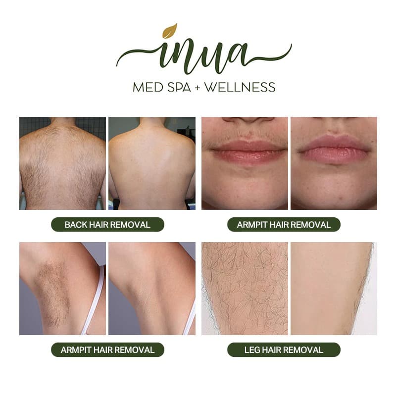 Inua Med Spa Snohomish LLC